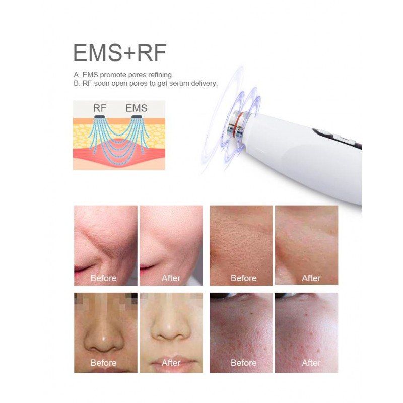 EMS RF NANO mesotherapy machine with IC chip control