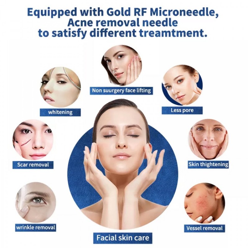 gold fractional rf microneedling machine for stretch mark acne wrinkle removal with cold hammer